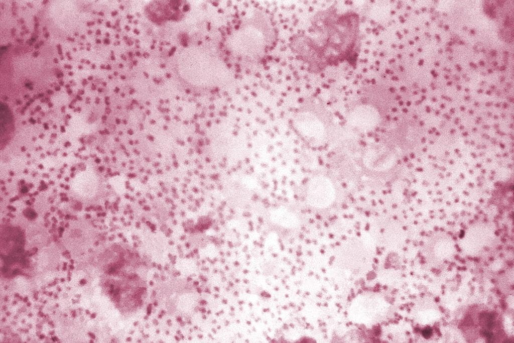 GettyImages-2259790983 plague